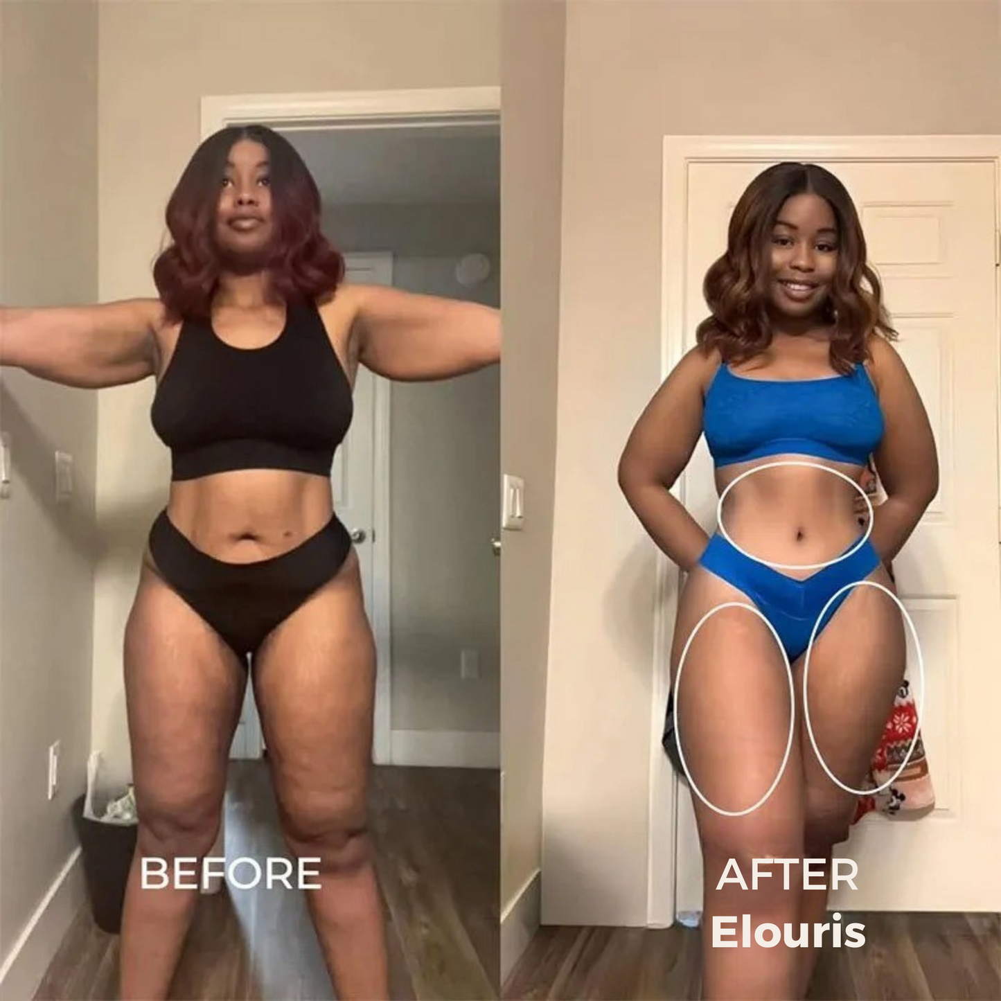 Firm and Tone Tool | Cellulite Relief Kit