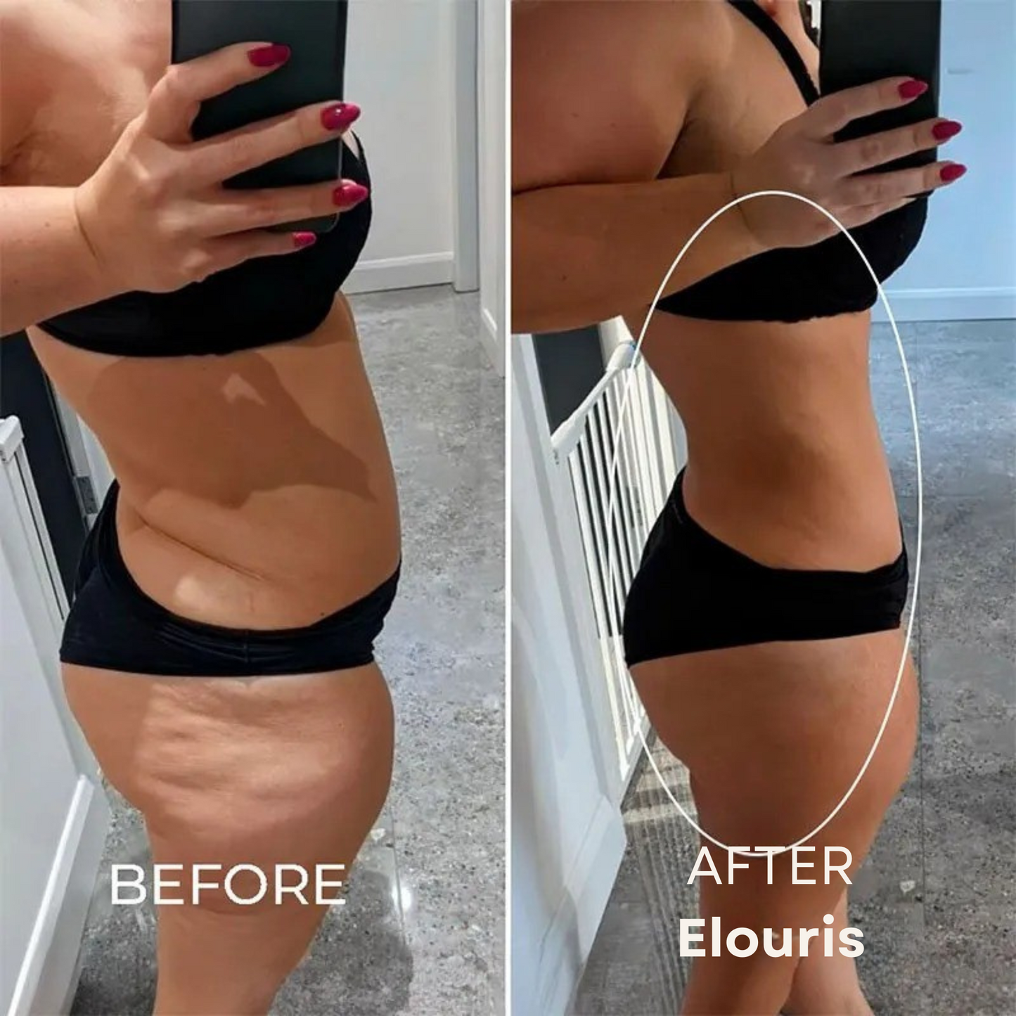 Firm and Tone Tool | Cellulite Relief Kit