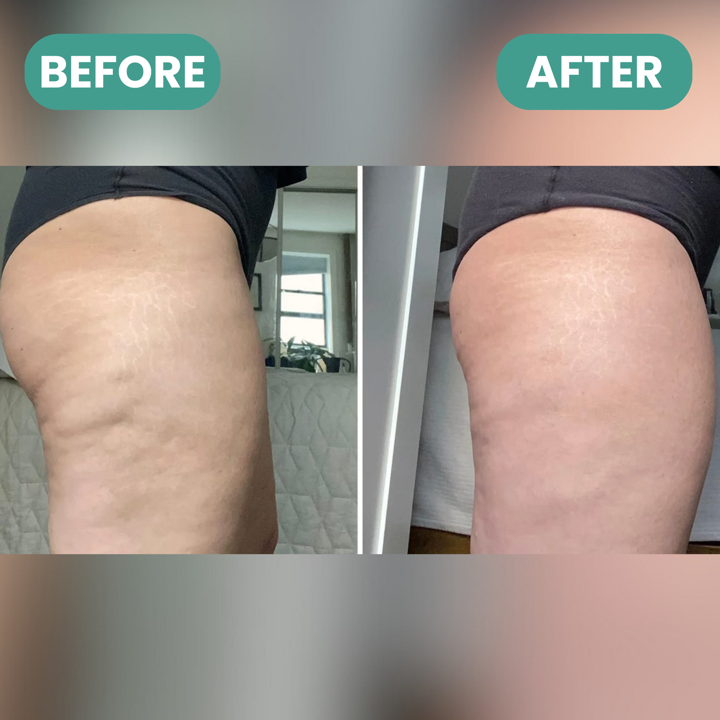 Anti-Cellulite | Firm & Tone Tool
